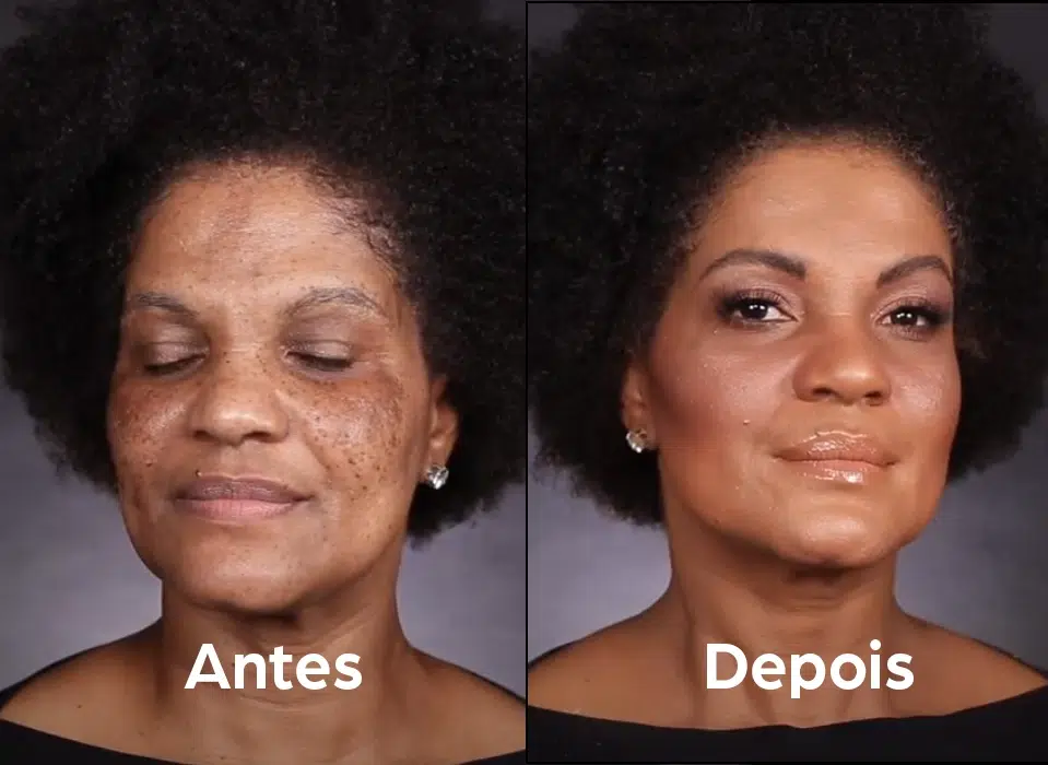 ANTES_DEPOIS_5