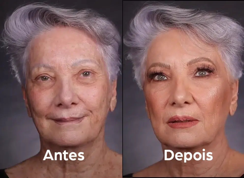 ANTES_DEPOIS_6