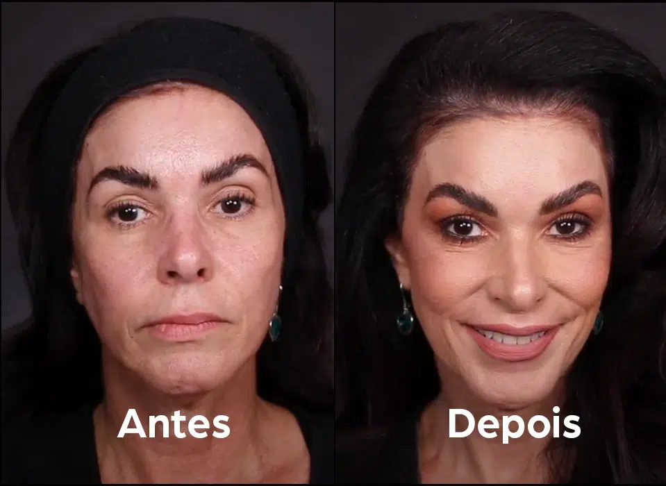 antes_depois_2
