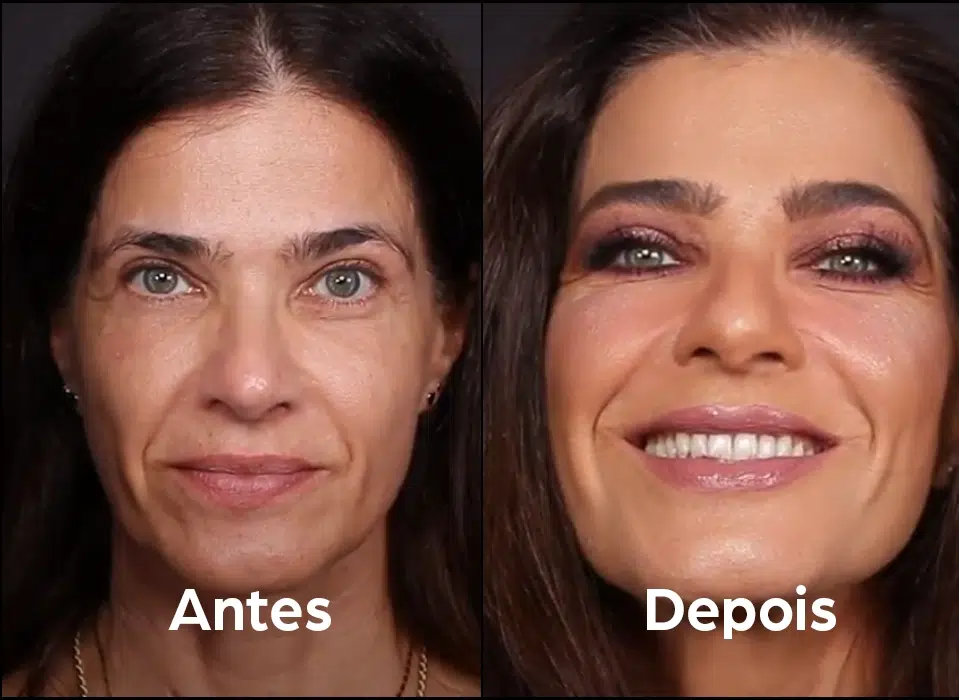 antes_depois_3